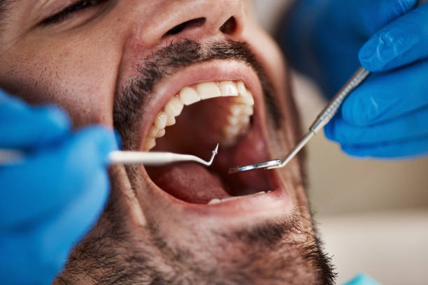 Urgent Tooth Repair in WA