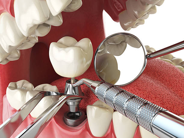 Best Urgent Tooth Repair  in Navy Yard City, WA